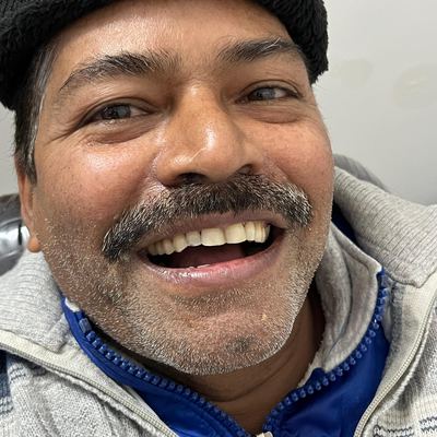 Smile Makeover After Treatment - M.A. Dental Clinic Lucknow